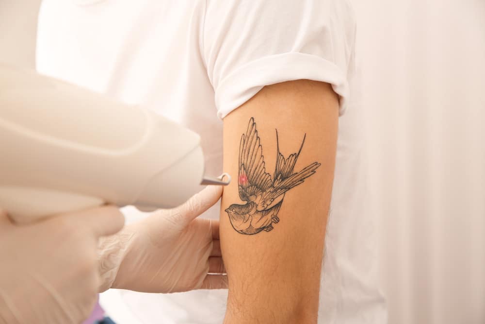 Young man undergoing laser tattoo removal procedure in salon closeup